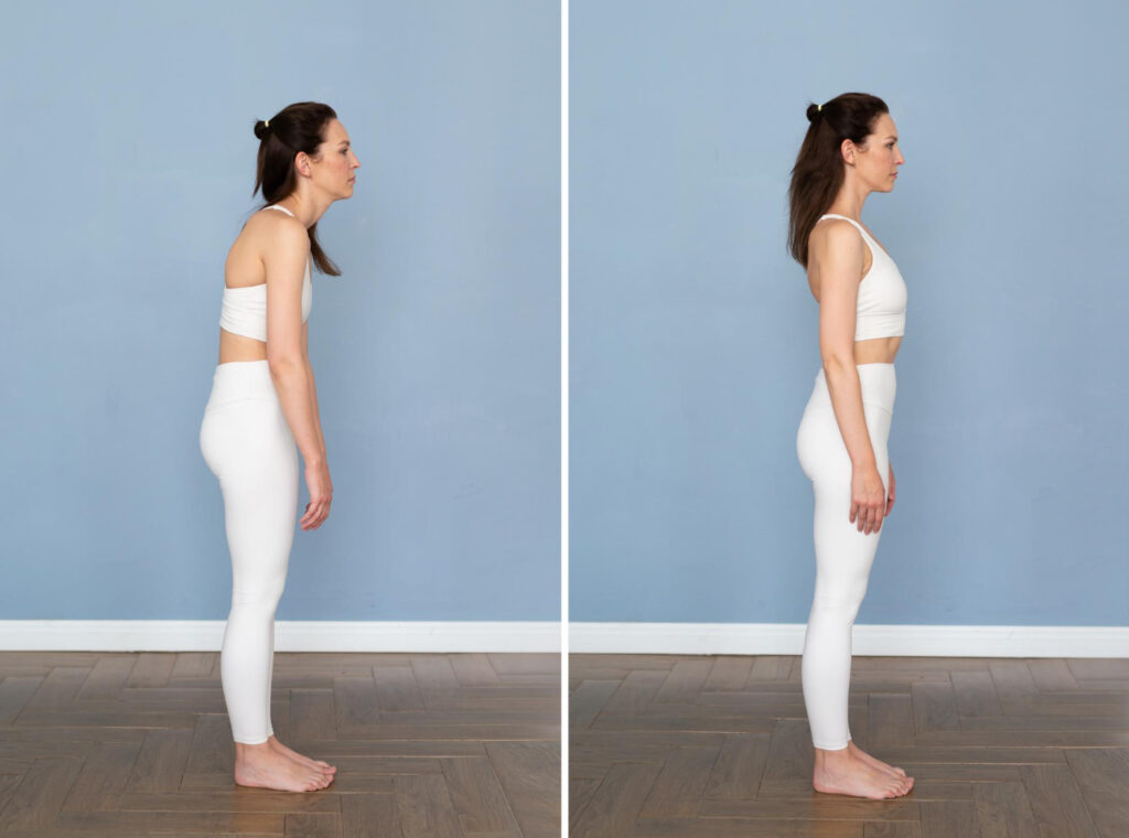 Posture Correction & Ergonomics